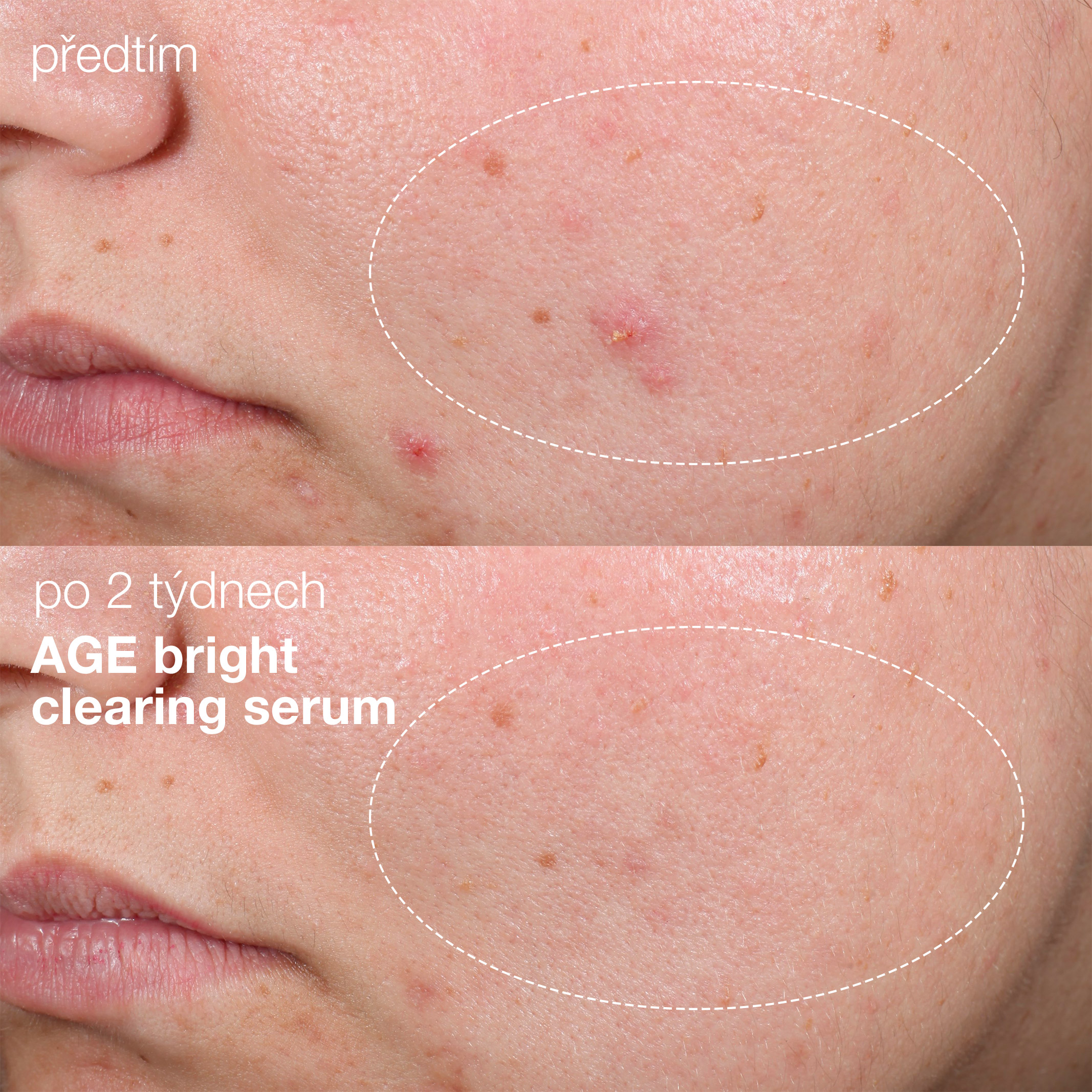 age-bright-clearing-serum_ba